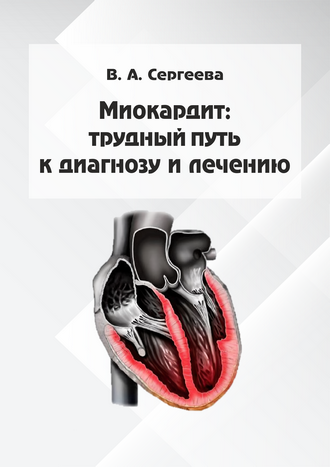 Миокардит: трудный путь к диагнозу и лечению: учебно-методическое пособие для практикующих врачей, клинических ординаторов, студентов медицинских вузов / сост. канд. мед. наук В. А. Сергеева; ФГБОУ ВО «Саратовский государственный медицинский университет им. В. И. Разумовского»